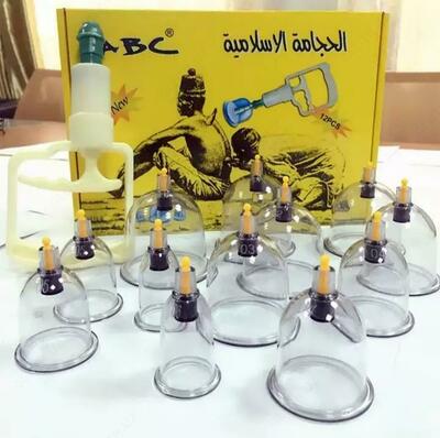 Hijama - vakuum stakanlari (qon quyish)